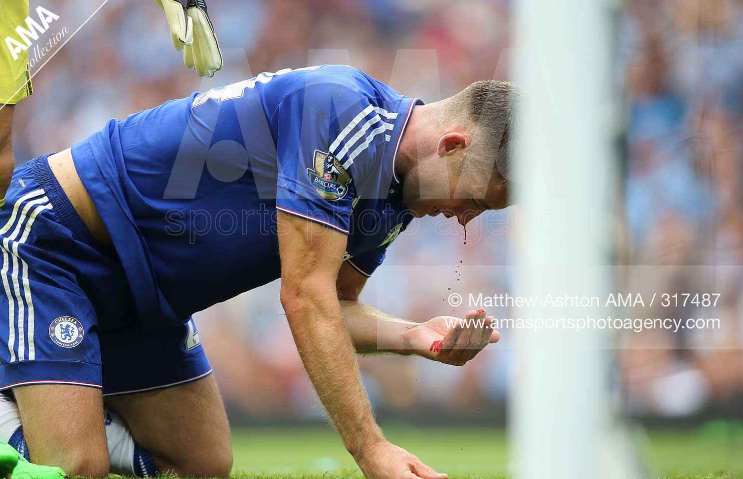16 August 2015  Barclays Premier League - Manchester City v Chelsea - Gary Cahill of Chelsea sees blood pouring from his nose after a collision with his goalkeeper Asmir Bergovic © Matthew Ashton / AMA 317487